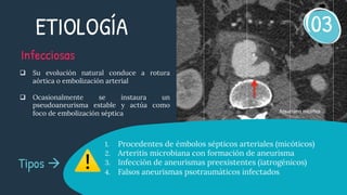 Aneurismas de la aorta abdominal | PDF