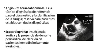 • Angio-RM toracoabdominal. Es la
técnica diagnóstica de referencia
para el diagnóstico y la planificación
de la cirugía; reserva para pacientes
estables con dudas diagnósticas
• Ecocardiografía: insuficiencia
aórtica y la presencia de derrame
pericárdico, de elección en
pacientes hemodinámicamente
inestables.
 