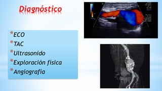 Diagnóstico
*ECO
*TAC
*Ultrasonido
*Exploración física
*Angiografía
 