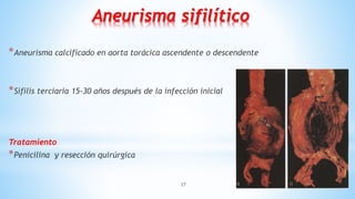 27
Aneurisma sifilítico
*Aneurisma calcificado en aorta torácica ascendente o descendente
*Sífilis terciaria 15-30 años después de la infección inicial
Tratamiento
*Penicilina y resección quirúrgica
 