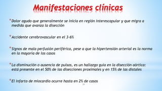 31
Manifestaciones clínicas
*Dolor agudo que generalmente se inicia en región interescapular y que migra a
medida que avanza la disección
*Accidente cerebrovascular en el 3-6%
*Signos de mala perfusión periférica, pese a que la hipertensión arterial es la norma
en la mayoría de los casos
*La disminución o ausencia de pulsos, es un hallazgo guía en la disección aórtica:
está presente en el 50% de las disecciones proximales y en 15% de las distales
*El infarto de miocardio ocurre hasta en 2% de casos
 