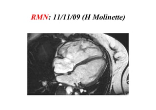 RMN: 11/11/09 (H Molinette)
 