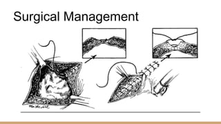 Surgical Management
 