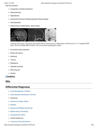 10/4/21, 9:12 PM https://emedicine.medscape.com/article/1161518-print
https://emedicine.medscape.com/article/1161518-print 9/29
See the list below:
Congenital or familial inheritance
Atherosclerosis
Hypertension
Autosomal dominant inherited polycystic kidney disease
Vasculopathies
Arteriovenous malformations, shown below
Cerebral aneurysms. Aneurysm associated with an arteriovenous malformation (AVM) shown on T1-weighted MRI
(left), 3D-time-of-flight MRI (middle), and conventional angiography (right).
Connective tissue disorders
Sickle cell anemia
Infections
Trauma
Neoplasms
Cigarette smoking
Illicit drug use
Alcohol
 
DDx
Differential Diagnoses
Acute Management of Stroke
Acute Subdural Hematoma in the ED
Anisocoria
Anterior Circulation Stroke
Aphasia
Apraxia and Related Syndromes
Basilar Artery Thrombosis
Cardioembolic Stroke
Carotid Ultrasound
Cavernous Sinus Syndromes
 