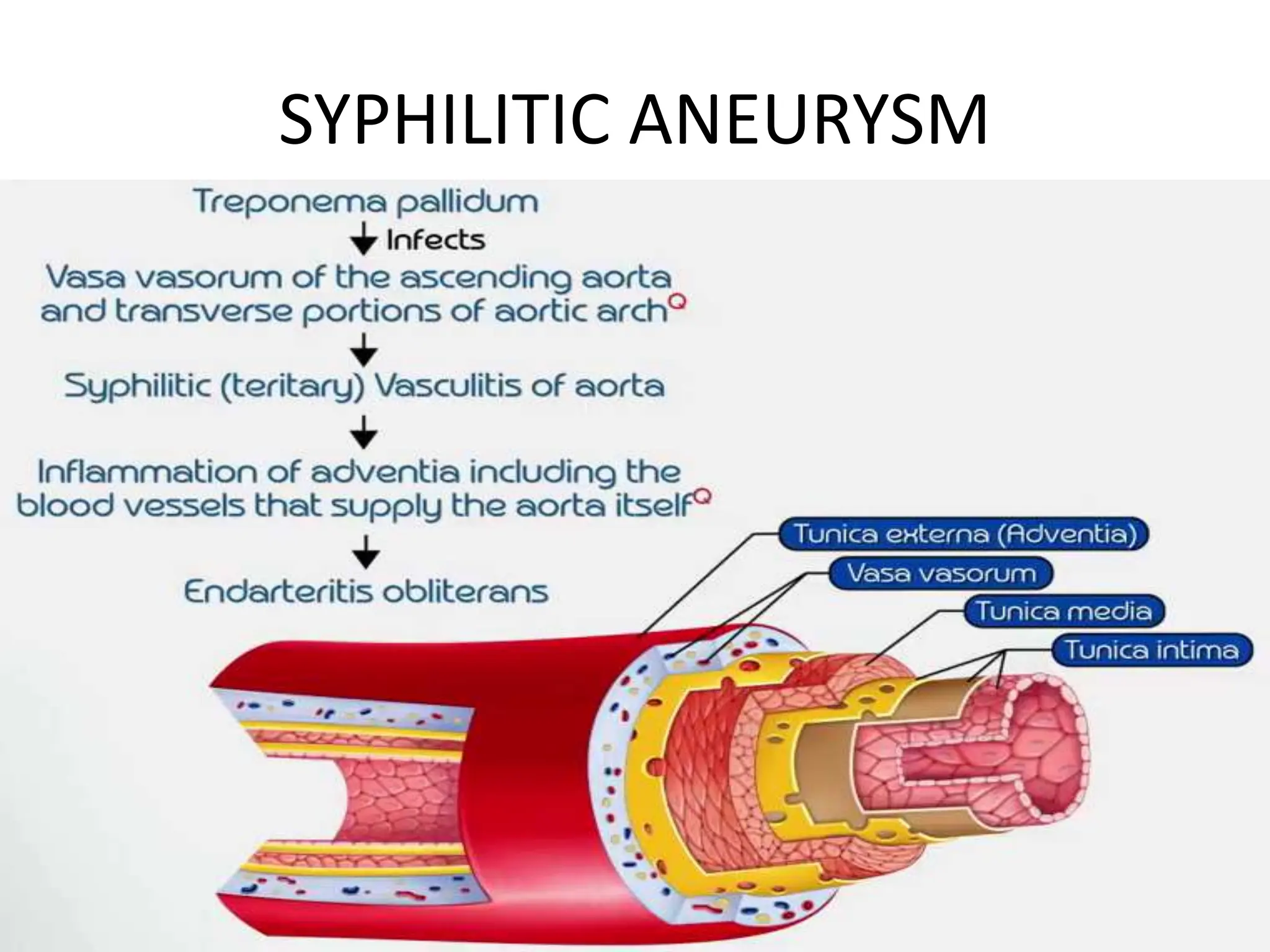 aneurysm pathology pptx from.robbins sss | PPT