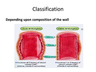 Classification
Depending upon composition of the wall
 