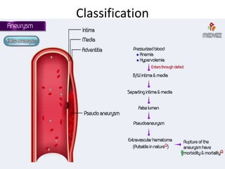 Classification
 