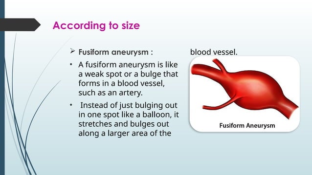 Aneurysm , classification of aneurysm and causes of aortic aneurysm | PPT