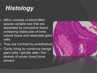 Aneurysmal Bone cyst presentation ortho.pptx