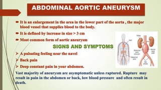 ABDOMINAL AORTIC ANEURYSM
Vast majority of aneurysm are asymptomatic unless raptured. Rupture may
result in pain in the abdomen or back, low blood pressure and often result in
death.
 
