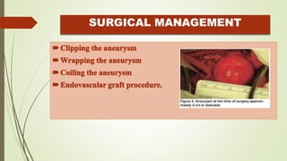 SURGICAL MANAGEMENT
 