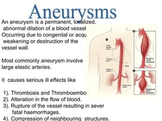 An aneurysm is a permanent, localized,
 abnormal dilation of a blood vessel
Occurring due to congenital or acquired
 weakening or destruction of the
vessel wall.

Most commonly aneurysm involve
large elastic arteries.

It causes serious ill effects like

1). Thrombosis and Thromboembolism.
2). Alteration in the flow of blood.
3). Rupture of the vessel resulting in sever
    fatal haemorrhages.
4). Compression of neighbouring structures.
 