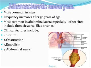  More common in men
 Frequency increases after 50 years of age.
 Most common in abdominal aorta especially other sites
include thoracic aorta, iliac arteries,
 Clinical features include,
 1.rupture
 2.Obstruction
 3.Embolism
 4.Abdominal mass
 