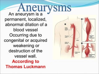 An aneurysm is a
permanent, localized,
abnormal dilation of a
blood vessel
Occurring due to
congenital or acquired
weakening or
destruction of the
vessel wall.
According to
Thomas Luckmann
 