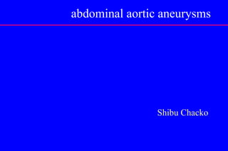 Shibu Chacko
abdominal aortic aneurysms
 