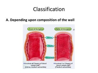 Classification
A. Depending upon composition of the wall
 