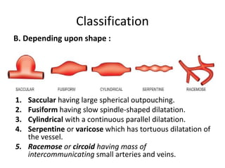 Classification
1. Saccular having large spherical outpouching.
2. Fusiform having slow spindle-shaped dilatation.
3. Cylindrical with a continuous parallel dilatation.
4. Serpentine or varicose which has tortuous dilatation of
the vessel.
5. Racemose or circoid having mass of
intercommunicating small arteries and veins.
B. Depending upon shape :
 