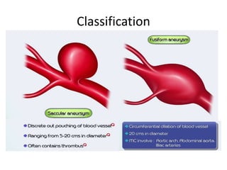 Classification
 
