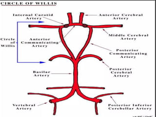 Circle Of Willis Aneurysm Causes
