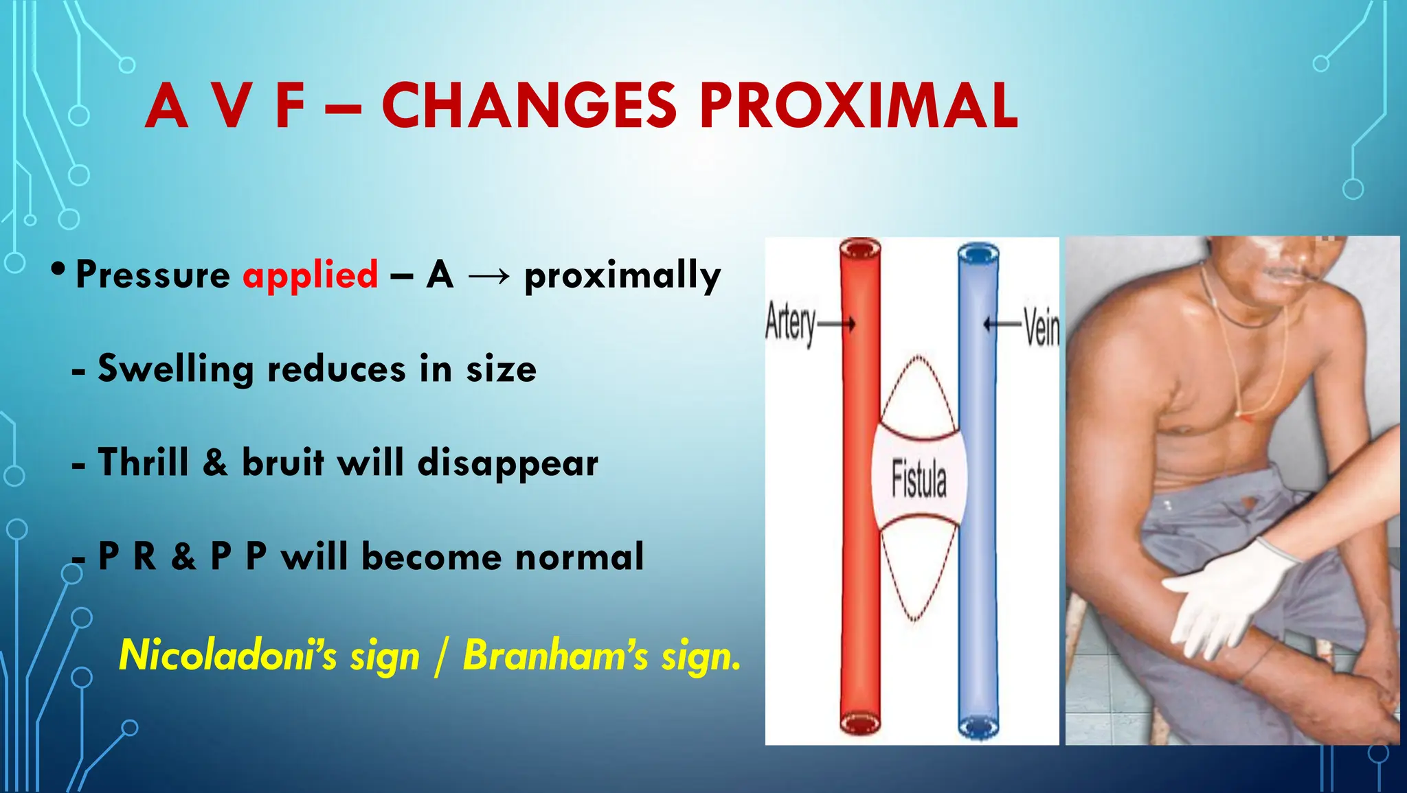 Aneurysms and Arterio-venous Fistula - PDF | PDF