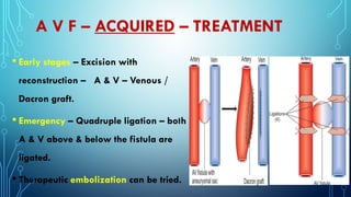 Aneurysms and Arterio-venous Fistula - PDF | PDF