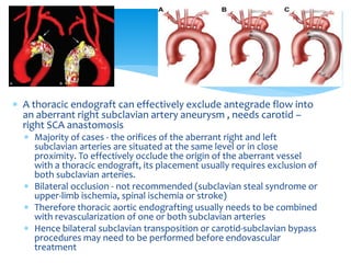 Aneurysms of upper and lower extremities + aneurysms | PPTX