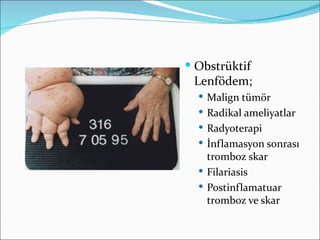  Obstrüktif
 Lenfödem;
   Malign tümör
   Radikal ameliyatlar
   Radyoterapi
   İnflamasyon sonrası
    tromboz skar
   Filariasis
   Postinflamatuar
    tromboz ve skar
 
