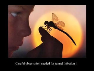 Careful observation needed for tunnel infection !
 