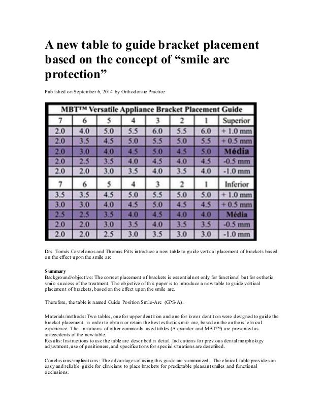 smile arc protection a new table to guide bracket placement based on
