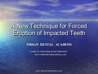 A New Technique for ForcedA New Technique for Forced
Eruption of Impacted TeethEruption of Impacted Teeth
www.indiandentalacademy.comwww.indiandentalacademy.com
INDIAN DENTAL ACADEMY
Leader in continuing dental education
www.indiandentalacademy.com
 