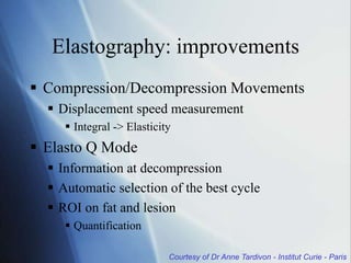 Courtesy of Dr Anne Tardivon - Institut Curie - Paris
Elastography: improvements
 Compression/Decompression Movements
 Displacement speed measurement
 Integral -> Elasticity
 Elasto Q Mode
 Information at decompression
 Automatic selection of the best cycle
 ROI on fat and lesion
 Quantification
 