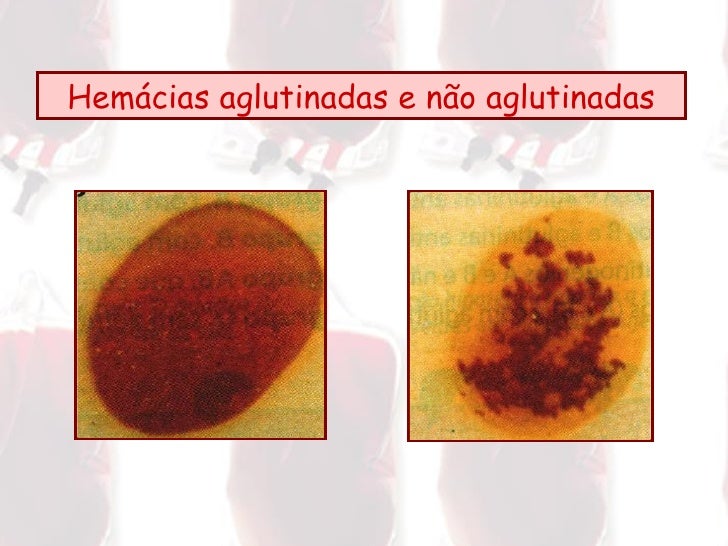 Anexo14 dar sangue
