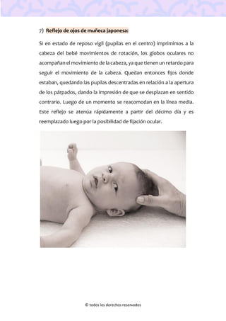 © todos los derechos reservados
7) Reflejo de ojos de muñeca japonesa:
Si en estado de reposo vigil (pupilas en el centro) imprimimos a la
cabeza del bebé movimientos de rotación, los globos oculares no
acompañan el movimiento de la cabeza, ya que tienen un retardo para
seguir el movimiento de la cabeza. Quedan entonces fijos donde
estaban, quedando las pupilas descentradas en relación a la apertura
de los párpados, dando la impresión de que se desplazan en sentido
contrario. Luego de un momento se reacomodan en la línea media.
Este reflejo se atenúa rápidamente a partir del décimo día y es
reemplazado luego por la posibilidad de fijación ocular.
 