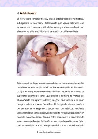 © todos los derechos reservados
2) Reflejo de Moro:
Es la reacción corporal masiva, difusa, estereotipada e inadaptada,
subsiguiente al sobresalto determinado por varios estímulos que
inducen a una brusca extensión de la cabeza que altera su relación con
el tronco. Ha sido asociado con la sensación de caída en el bebé.
Existe en primer lugar una extensión bilateral y una abducción de los
miembros superiores (de ahí el nombre de reflejo de los brazos en
cruz). A esto sigue un retorno hacia la línea media de los miembros
superiores delante del tórax (que origina el nombre de “reflejo del
abrazo” dado por algunos autores). Luego el niño vuelve a la posición
que precediera a la reacción refleja. El tiempo del abrazo tiende a
desaparecer en el segundo o tercer mes. Los médicos, mediante
varias maniobras semiológicas, exploran este reflejo: ubicado el RN en
posición decúbito dorsal, dan un golpe seco sobre la superficie de
apoyo o soplan el rostro del bebé con una mano bajo el tronco y dejan
caer hacia atrás la cabeza. La respuesta de los brazos superiores es lo
 