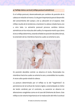 © todos los derechos reservados
4) Reflejo tónico cervical (reflejo postural asimétrico):
Es el reflejo postural, desencadenado por cambios de posición de la
cabeza en relación al tronco. Es de gran importancia para el desarrollo
del conocimiento del cuerpo y de su ubicación en el espacio. Este
reflejo resulta de la tendencia a mantener la cabeza rotada hacia uno
u otro lado. La asimetría postural provoca cambios tónicos
asimétricos en los músculos del cuello y la respuesta motriz que cierra
el arco reflejo determina, estando el bebé en posición decúbito dorsal,
la extensión de los miembros hacia los cuales se orienta la cara.
En posición decúbito ventral. se observa al revés, flexionados los
miembros hacia los cuales se orienta la cara y extendidos los nucales.
A veces sólo queda rotada la cabeza.
La postura determinada por el reflejo es la del “esgrimista”; la
persistencia de tal actitud de manera rígida y estereotipada es índice
de lesión cerebral; por el contrario, su ausencia se observa en
alteraciones congénitas como en el caso del Síndrome de Down. Este
reflejo es de notoria importancia en la maduración del niño: la actitud
 