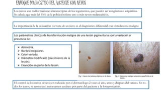 Los nevos son malformaciones circunscriptas de los tegumentos, que pueden ser congénitos o adquiridos.
Se calcula que más del 95% de la población tiene uno o más nevos melanocíticos.
ENFOQUE DIAGNÓSTICO DEL PACIENTE CON NEVOS
La importancia de la evaluación correcta de un nevo es el diagnóstico diferencial con el melanoma maligno
 Asimetría.
 Bordes irregulares.
 Color variado.
 Diámetro modificado (crecimiento de la
lesión).
 Elevación en parte de la lesión.
El control de los nevos deberá ser realizado por el dermatólogo 2 veces al año, antes y después del verano. En to-
dos los casos, se aconseja el autoexamen cutáneo por parte del paciente y la fotoprotección.
Los parámetros clínicos de transformación maligna de una lesión pigmentaria son la variación o
presencia de:
 
