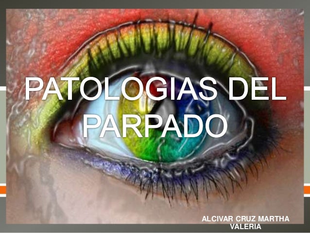El aceite shi el tratamiento de la psoriasis