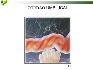 CORDÃO UMBILICAL
13
 