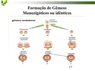 17
Formação de Gêmeos
Monozigóticos ou idênticos
 