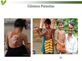 21
Gêmeos Parasitas
 