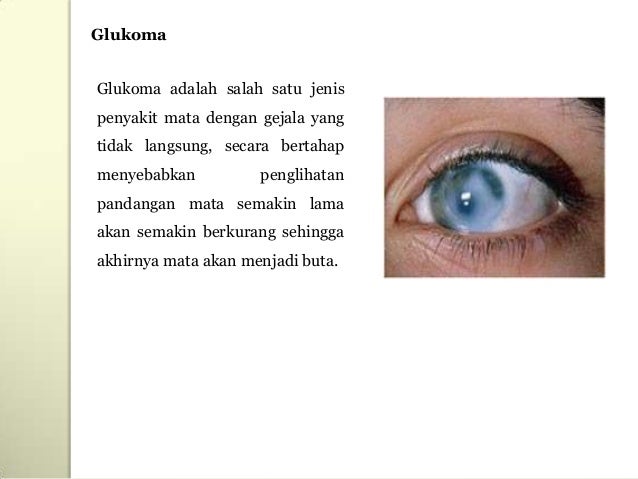 Sistem Penglihatan Sistem Penglihatan