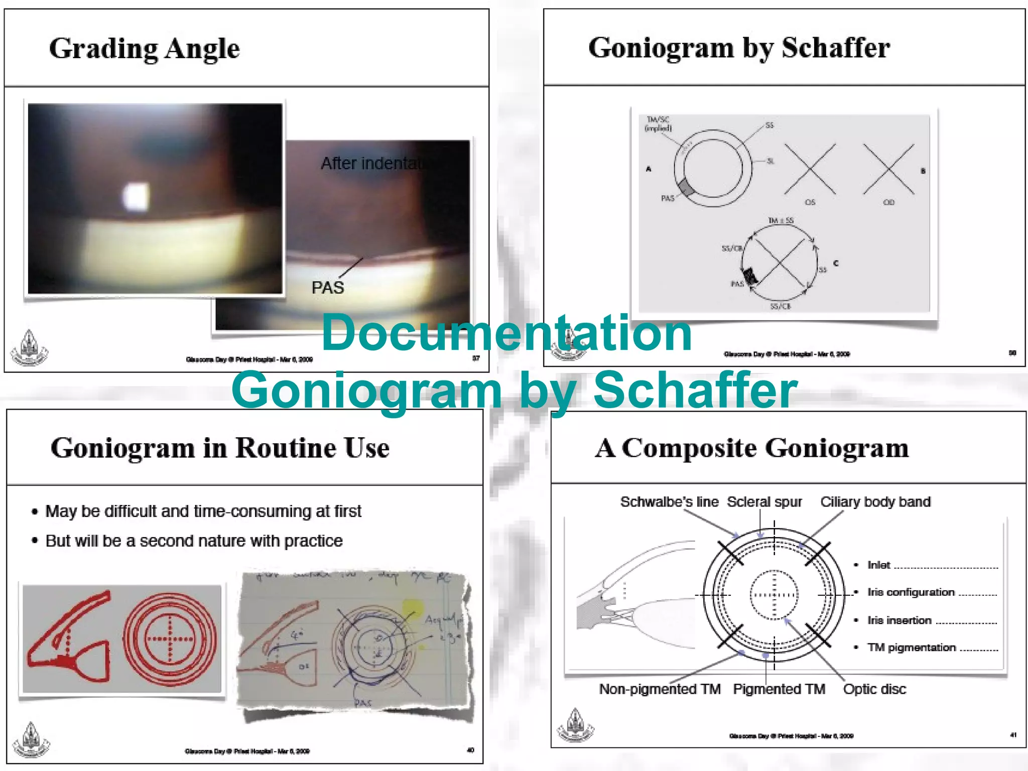 Documentation  Goniogram by Schaffer 