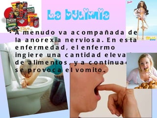 La bulimia A menudo va acompañada de la anorexia nerviosa. En esta enfermedad, el enfermo ingiere una cantidad elevada de alimentos, y a continuación se provoca el vomito. 