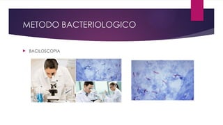 METODO BACTERIOLOGICO
 BACILOSCOPIA
 