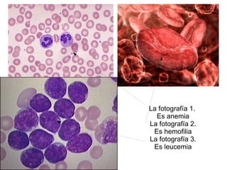 - glóbulos rojos, eritrocitos y hematíes