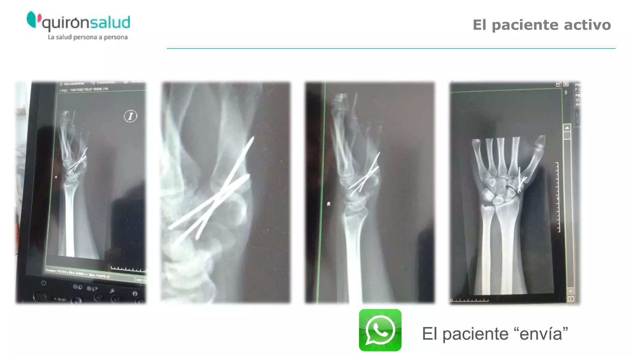 El paciente “envía”
El paciente activo
 