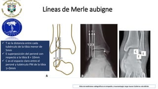 mediciones radiologicas.pptx