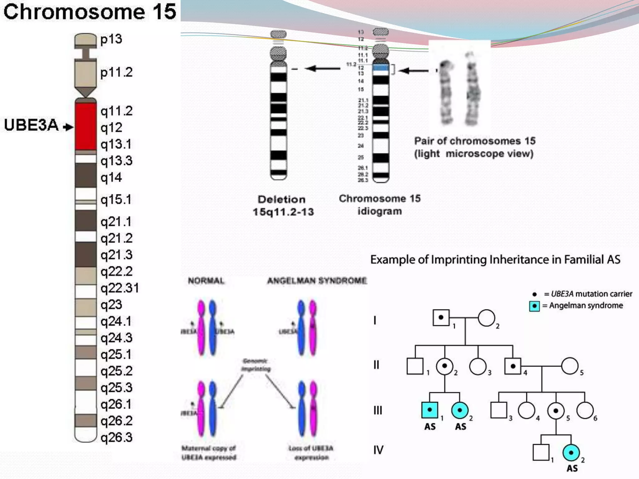 Ladder Angelman Angelman Syndrome Missing Chromosome