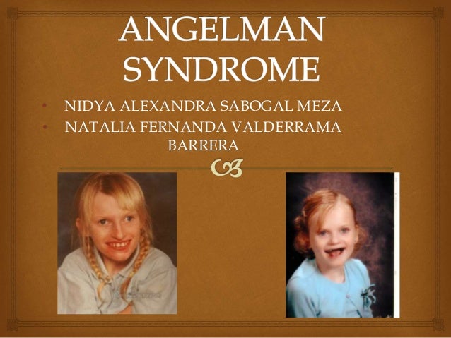 angelman syndrome angels powerpoint