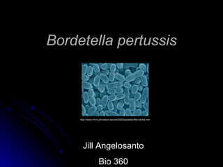Bordetella pertussis http://www.hhmi.princeton.edu/sw/2002/psidelsk/Microlinks.htm Jill Angelosanto Bio 360 